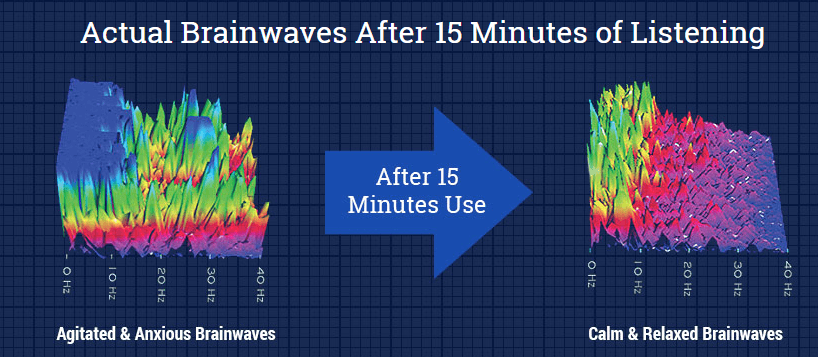 Brain waves